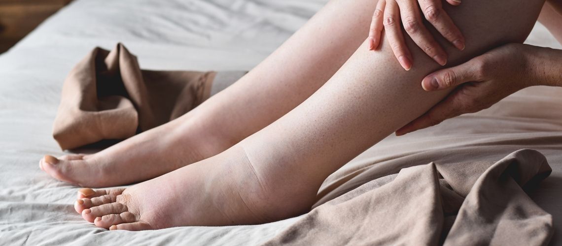 Ödem Nedir? Ödem Nasıl Atılır?