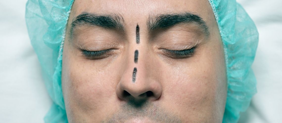 Etnik Burun Estetiği Fiyatları