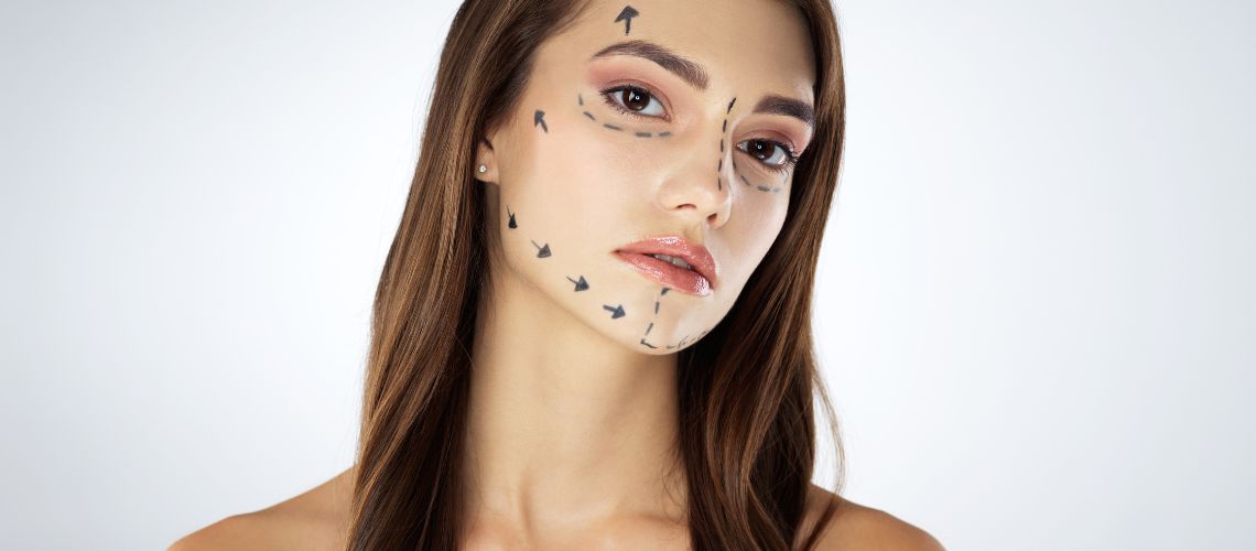 Kemerli Burun Nedir? Kemerli Burun Estetiği Nasıl Yapılır?